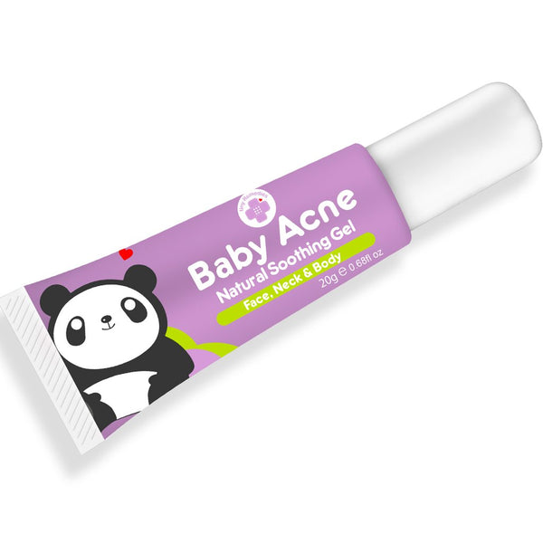 Tiny Buds Baby Acne Natural Soothing Gel 20g